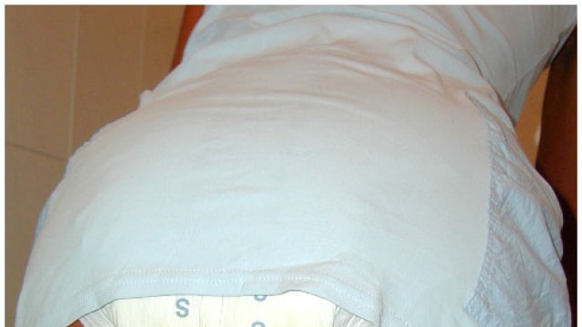 Set_dg158