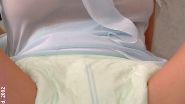 Set_dg431